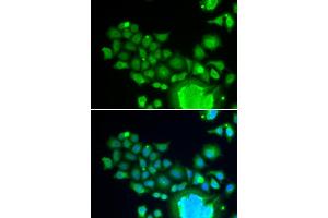 Immunofluorescence analysis of HeLa cells using FZR1 antibody (ABIN6130399, ABIN6140852, ABIN6140854 and ABIN6221196). (FZR1 抗体  (AA 224-493))