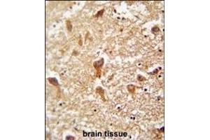 Immunohistochemistry (Paraffin-embedded Sections) (IHC (p)) image for anti-Phosphatidylinositol Glycan Anchor Biosynthesis, Class X (PIGX) (AA 67-95), (N-Term) antibody (ABIN654478)