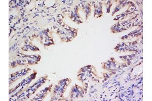 Formalin-fixed and paraffin embedded rat lung labeled with Anti- Preproendothelin 1 Polyclonal Antibody, Unconjugated  at 1:200 followed by conjugation to the secondary antibody and DAB staining (Prepro-Endothelin-1 (AA 16-110) 抗体)
