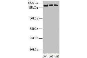 Western blot All lanes: ZNF546 antibody at 4 μg/mL Lane 1: A549 whole cell lysate Lane 2: 293T whole cell lysate Lane 3: Hela whole cell lysate Secondary Goat polyclonal to rabbit IgG at 1/10000 dilution Predicted band size: 99 kDa Observed band size: 99 kDa (ZNF546 抗体  (AA 1-300))