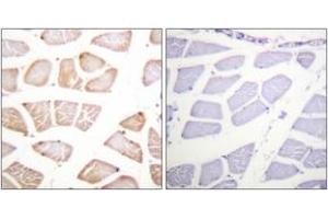Immunohistochemistry analysis of paraffin-embedded human skeletal muscle tissue, using Akt (Ab-129) Antibody. (AKT1 抗体  (AA 95-144))