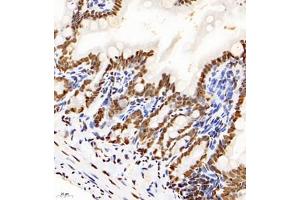 Immunohistochemistry analysis of paraffin-embedded mouse ileum using HNRNPM (ABIN7074247) at dilution of 1: 4000 (HnRNP M1-M4 抗体)