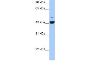 WB Suggested Anti-FGFR1OP Antibody Titration: 0. (FGFR1OP 抗体  (N-Term))