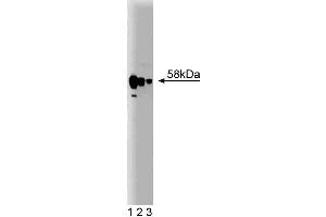Western blot analysis of PP5 on a rat cerebrum lysate. (PP5 抗体  (AA 36-238))