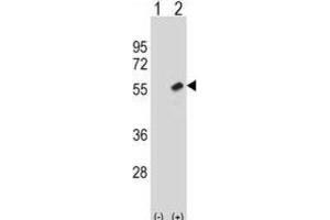Western Blotting (WB) image for anti-Retinoblastoma Binding Protein 7 (RBBP7) antibody (ABIN2998665) (RBBP7 抗体)