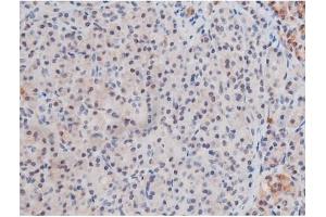 Immunohistochemistry (IHC) image for anti-Signal Transducer and Activator of Transcription 3 (Acute-Phase Response Factor) (STAT3) (pSer727) antibody (ABIN6256411)