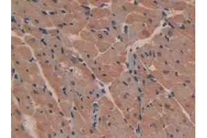 Immunohistochemistry (IHC) image for anti-ATPase, Ca++ Transporting, Plasma Membrane 2 (ATP2B2) (AA 417-830) antibody (ABIN7436264)