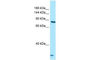 Western Blotting (WB) image for anti-Thyroid adenoma-associated protein (THADA) (C-Term) antibody (ABIN2789989) (THADA 抗体  (C-Term))