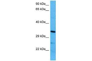 Host:  Mouse  Target Name:  MBD3  Sample Tissue:  Mouse Brain  Antibody Dilution:  1ug/ml (MBD3 抗体  (N-Term))