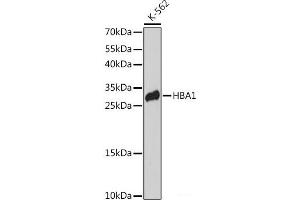 Western blot analysis of extracts of K-562 cells using HBA1 Polyclonal Antibody at dilution of 1:3000. (HBA1 抗体)