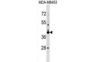 Western Blotting (WB) image for anti-SRR1 Domain Containing (SRRD) antibody (ABIN2999110) (SRRD 抗体)