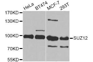 Western blot analysis of extracts of various cell lines, using SUZ12 Antibody (ABIN5975314) at 1/1000 dilution. (SUZ12 抗体)