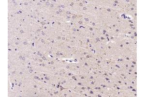 Immunohistochemistry (Paraffin-embedded Sections) (IHC (p)) image for anti-Heat Shock Protein 90kDa alpha (Cytosolic), Class B Member 1 (HSP90AB1) (AA 635-724) antibody (ABIN725495)