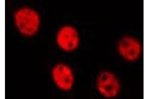 ABIN6275507 staining HepG2 by IF/ICC. (RFWD3 抗体  (N-Term))