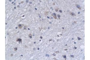 Formalin-fixed and paraffin embedded rat brain tissue labeled with Anti-Bak Polyclonal Antibody, Unconjugated (ABIN674409) followed by conjugation to the secondary antibody and DAB staining (BAK1 抗体  (AA 21-120))