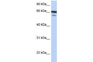 WB Suggested Anti-MAP3K7IP1 Antibody Titration: 0. (TAB1 抗体  (N-Term))