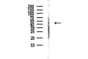 Western blot analysis of lysates from HUVEC cells(UV,30 min treatment), using IL12B Antibody at 1/1000 dilution.