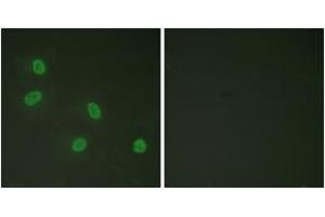 Immunofluorescence analysis of HeLa cells, using PPAR-BP (Phospho-Thr1457) Antibody. (PPAR-BP (AA 1423-1472), (pThr1457) 抗体)
