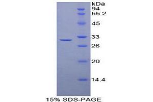 SDS-PAGE analysis of Mouse Transaldolase Protein. (TALDO1 蛋白)