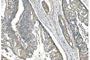 IHC analysis of IMPDH1 using anti-IMPDH1 antibody (ABIN7599864).