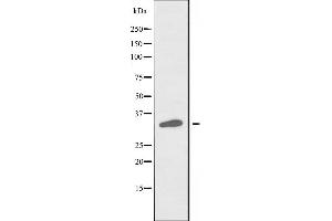 Western blot analysis of extracts from COLO cells, using SLC25A31 antibody. (SLC25A31 抗体  (Internal Region))
