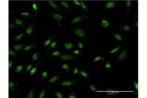 Immunofluorescence of monoclonal antibody to TBL1XR1 on HeLa cell. (TBL1XR1 抗体  (AA 81-178))