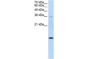 UBE2D2 antibody used at 1.