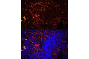 Immunofluorescence analysis of rat spleen using CD11a/LFA-1A/ITGAL Polyclonal Antibody (ABIN3015541, ABIN3015542, ABIN3015543, ABIN1680526 and ABIN6218728) at dilution of 1:100 (40x lens). (ITGAL 抗体  (AA 26-306))