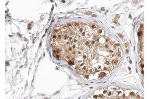 ABIN6267694 at 1/100 staining human testis tissue sections by IHC-P. (HDAC6 抗体  (pSer22))