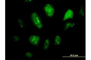Immunofluorescence of monoclonal antibody to GCM1 on HeLa cell. (GCM1 抗体  (AA 108-166))