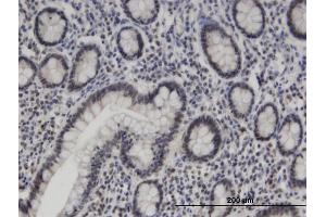 Immunoperoxidase of monoclonal antibody to ZNF138 on formalin-fixed paraffin-embedded human small Intestine. (ZNF138 抗体  (AA 151-251))