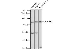 Western blot analysis of extracts of various cell lines, using ZCWPW1 antibody (ABIN6133087, ABIN6150412, ABIN6150413 and ABIN6223508) at 1:1000 dilution. (ZCWPW1 抗体  (AA 389-648))