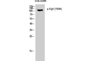 Western Blotting (WB) image for anti-Kinesin Family Member 11 (KIF11) (pThr926) antibody (ABIN5961163) (KIF11 抗体  (pThr926))
