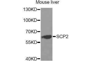 Western blot analysis of extracts of mouse liver, using SCP2 Antibody. (SCP2 抗体)