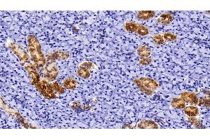Detection of CK5 in Rat Parotid Gland Tissue using Polyclonal Antibody to Cytokeratin 5 (CK5) (Cytokeratin 5 抗体  (AA 335-473))