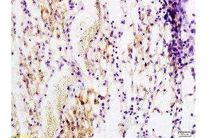 Formalin-fixed and paraffin embedded rat transplant lymphoma labeled with Anti-PDGF-B Polyclonal Antibody, Unconjugated  at 1:200 followed by conjugation to the secondary antibody and DAB staining (PDGFB 抗体  (AA 155-210))