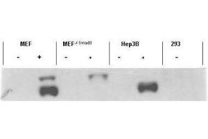 Western blot using  affinity purified anti-Smad3 pS423 pS425 antibody shows detection of endogenous Smad3 in stimulated cell lysates. (SMAD3 抗体  (pSer423, pSer425))