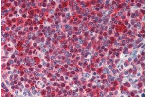 Human Spleen (formalin-fixed, paraffin-embedded) stained with HSPA8 antibody ABIN462103 at 10 ug/ml followed by biotinylated secondary antibody, alkaline phosphatase-streptavidin and chromogen.