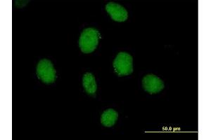 Immunofluorescence of purified MaxPab antibody to SDCCAG10 on HeLa cell. (Cwc27 抗体  (AA 1-291))