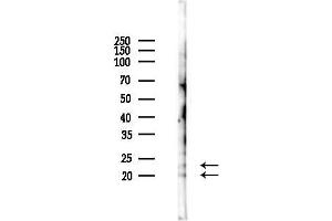 anti-ASF1 Anti-Silencing Function 1 Homolog A (S. Cerevisiae) (ASF1A) (pSer166) antibody