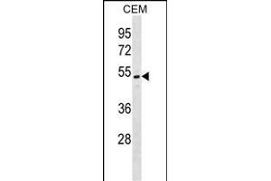 ONECUT2 Antibody (N-term) (ABIN1538931 and ABIN2848980) western blot analysis in CEM cell line lysates (35 μg/lane). (ONECUT2 抗体  (N-Term))