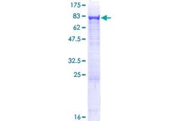 Asparagine Synthetase Protein (ASNS) (AA 1-561) (GST tag)