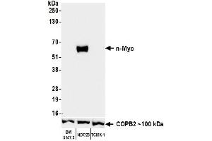 Western Blotting (WB) image for anti-N-Myc Proto-Oncogene Protein (MYCN) (AA 100-150) antibody (ABIN7795786) (Recombinant MYCN 抗体  (AA 100-150))
