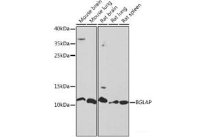 Western blot analysis of extracts of various cell lines using BGLAP Polyclonal Antibody at dilution of 1:1000. (Osteocalcin 抗体)