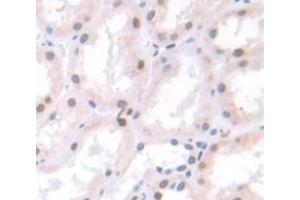 Used in DAB staining on fromalin fixed paraffin- embedded Kidney tissue (Spt6 抗体  (AA 532-666))