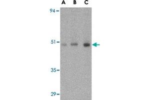 Western blot analysis of ORAI1 in human ovary tissue lysate with ORAI1 polyclonal antibody  at (A) 0. (ORAI1 抗体  (C-Term))