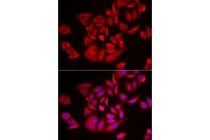 Immunofluorescence analysis of U2OS cell using TLK2 antibody. (TLK2 抗体)