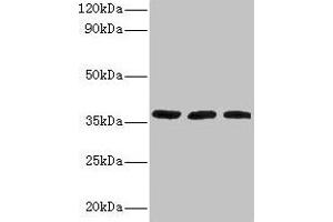 Western blot All lanes: FTSJ1 antibody at 2 μg/mL Lane 1: HepG2 whole cell lysate Lane 2: Mouse brain tissue Lane 3: EC109 whole cell lysate Secondary Goat polyclonal to rabbit IgG at 1/15000 dilution Predicted band size: 37, 36 kDa Observed band size: 37 kDa (FTSJ1 抗体  (AA 1-329))