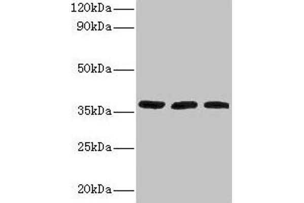 FTSJ1 Antikörper  (AA 1-329)