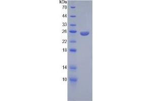 SDS-PAGE of Protein Standard from the Kit  (Highly purified E. (Angiopoietin 2 ELISA 试剂盒)
